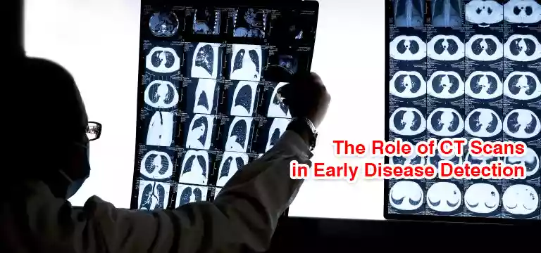 The Role of CT Scans in Early Disease Detection